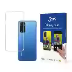 Чохол 3mk Skinny Case для Xiaomi Redmi Note 11 | 11s 4G Transparent (5903108473064)