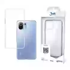 Чохол 3mk Skinny Case для Xiaomi Mi 11 Lite 4G | 5G | 11 Lite 5G NE Clear (5903108458412)